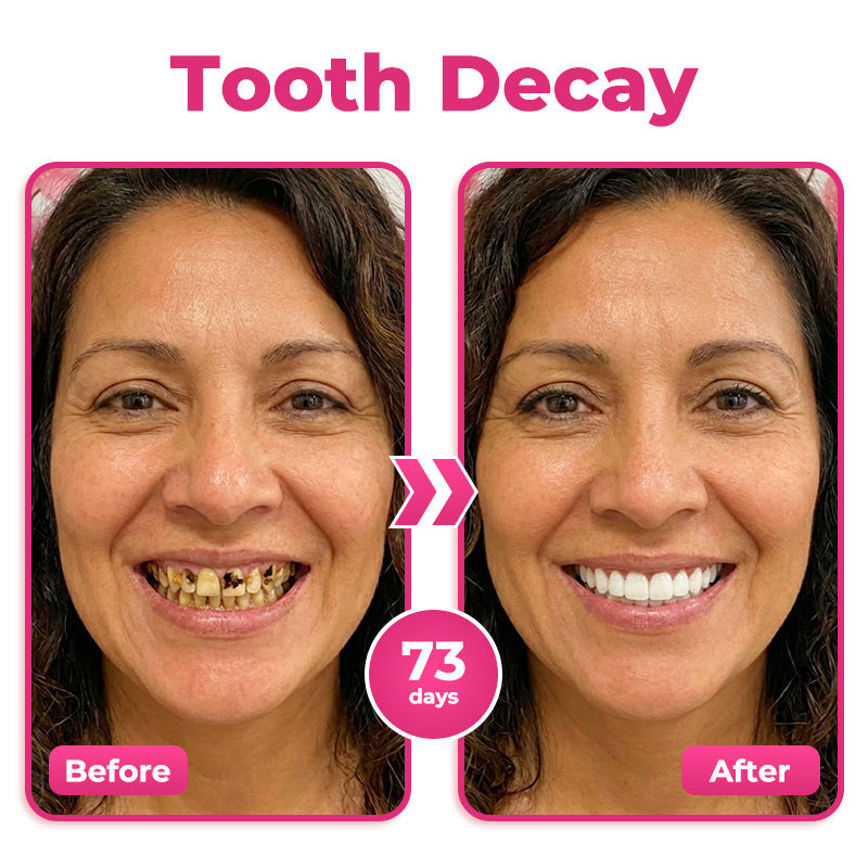 🦷Natravor® Thismile NH-10 Toothpaste Serum for Enamel and Gum Care – Advanced Therapy🪥