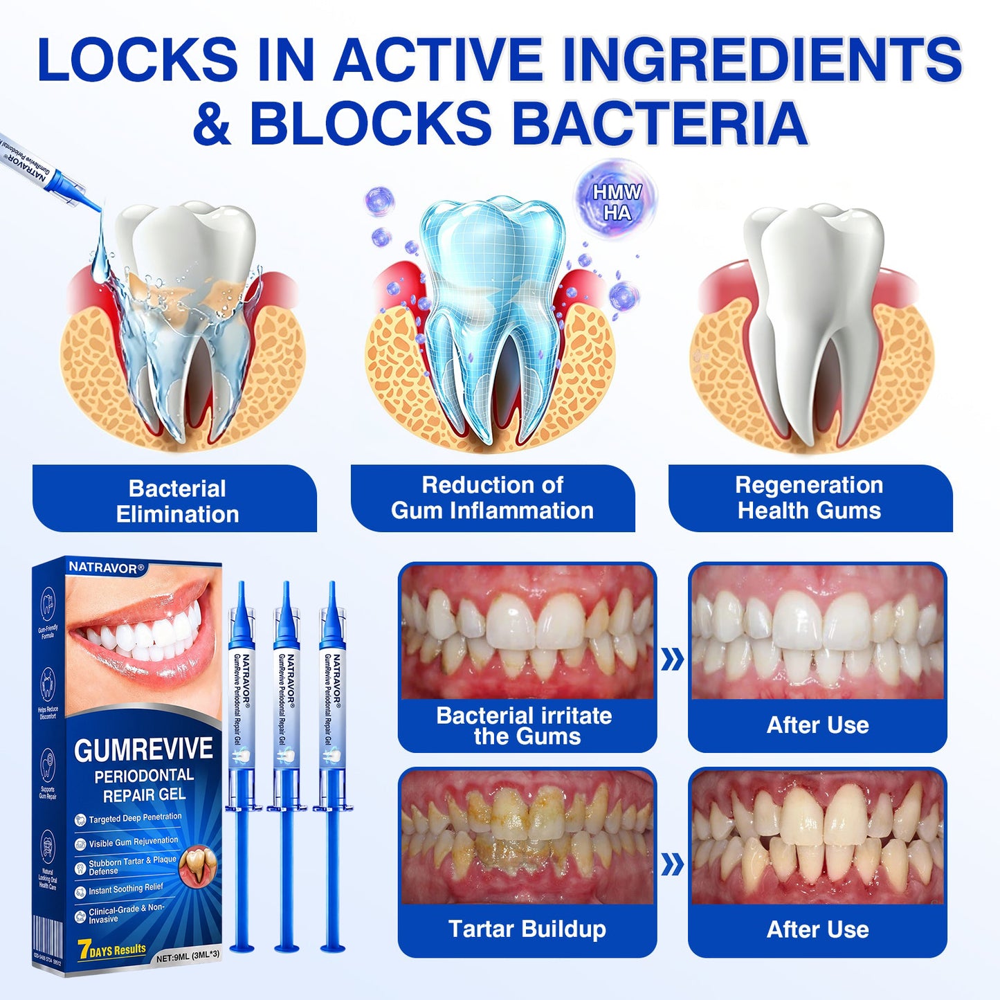 CA🦷😘NATRAVOR® GumCare Pro Advanced Gum Care Gel