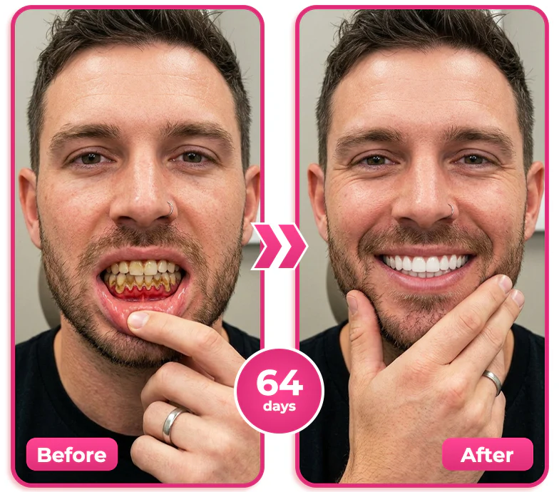 🎈Natravor® Thismile NH-10 Toothpaste Serum for Enamel and Gum Care – Advanced Therapy🪥